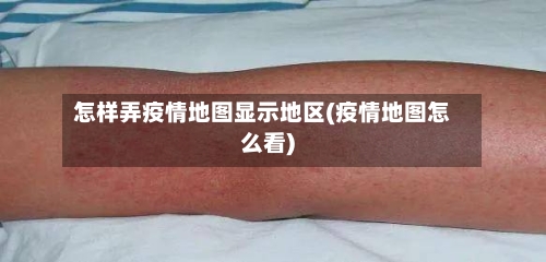 怎样弄疫情地图显示地区(疫情地图怎么看)