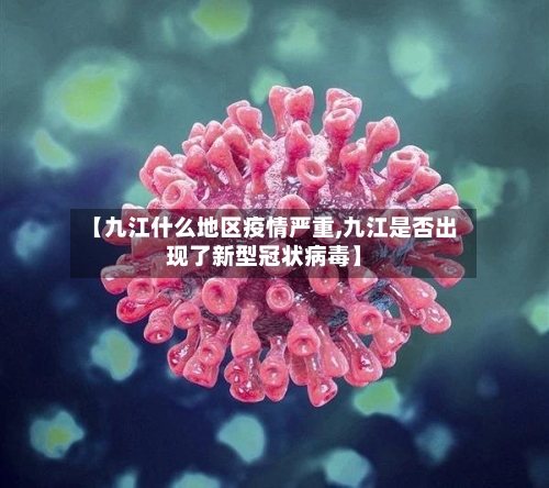 【九江什么地区疫情严重,九江是否出现了新型冠状病毒】-第3张图片